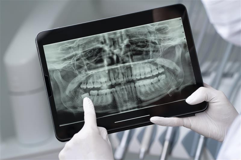 Dental x-ray displayed on tablet